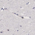 Immunohistochemical staining of human cerebral cortex using Anti-RENBP antibody HPA000428.