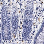 Immunohistochemical staining of human colon using Anti-RENBP antibody HPA000428.