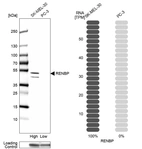 Western blot analysis in human cell lines SK-MEL-30 and PC-3 using Anti-RENBP antibody. Corresponding RENBP RNA-seq data are presented for the same cell lines. Loading control: Anti-GAPDH.