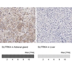 Anti-SLITRK4 Antibody