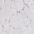 Immunohistochemical staining of human skeletal muscle shows no membranous positivity in myocytes as expected.