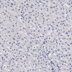 Immunohistochemical staining of human liver shows no membranous positivity in hepatocytes as expected.
