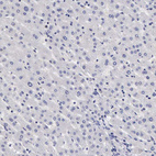 Anti-SLITRK4 Antibody