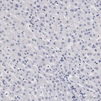 Immunohistochemical staining of human liver shows no membranous positivity in hepatocytes as expected.