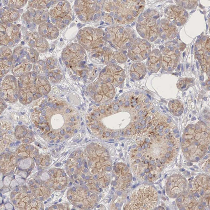 Anti-PCDH11X Antibody