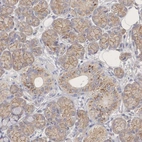 Anti-PCDH11X Antibody