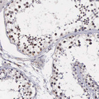 Anti-MORC2 Antibody