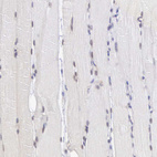 Anti-MORC2 Antibody