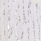 Immunohistochemical staining of human skeletal muscle shows moderate nuclear positivity in myocytes.