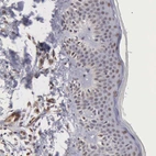 Immunohistochemical staining of human skin shows strong nuclear positivity in squamous epithelial cells.