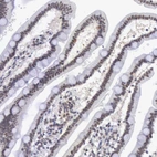 Immunohistochemical staining of human duodenum shows moderate nuclear positivity in glandular cells.