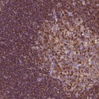 Anti-PTPRC Antibody