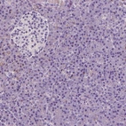 Immunohistochemical staining of human pancreas shows low expression as expected.