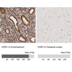 Anti-ESR1 Antibody