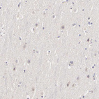 Immunohistochemical staining of human cerebral cortex shows no positivity in neurons as expected.