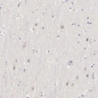 Immunohistochemical staining of human cerebral cortex shows no positivity in neurons as expected.