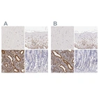 Immunohistochemical staining of human cerebral cortex, cervix, uterine, endometrium and gastrointestinal using Anti-ESR1 antibody HPA000449 (A) shows similar protein distribution across tissues to independent antibody HPA000450 (B).