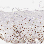 Immunohistochemical staining of human uterine cervix shows strong nuclear positivity in squamous epithelial cells.