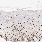 Immunohistochemical staining of human uterine cervix shows strong nuclear positivity in squamous epithelial cells.