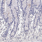 Immunohistochemical staining of human small intestine shows no positivity in glandular cells as expected.