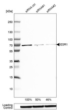 Western blot analysis in MCF-7 cells transfected with control siRNA, target specific siRNA probe #1 and #2, using Anti-ESR1 antibody. Remaining relative intensity is presented. Loading control: Anti-GAPDH.