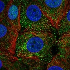 Immunofluorescent staining of human cell line MCF7 shows localization to nucleus & vesicles.