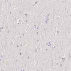 Immunohistochemical staining of human cerebral cortex shows no positivity in neurons as expected.