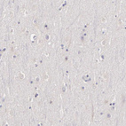 Anti-ESR1 Antibody