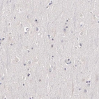 Immunohistochemical staining of human cerebral cortex shows no positivity in neurons as expected.