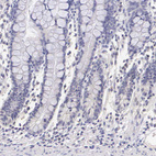 Immunohistochemical staining of human small intestine shows no positivity in glandular cells as expected.