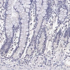 Immunohistochemical staining of human small intestine shows no positivity in glandular cells as expected.