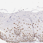 Immunohistochemical staining of human uterine cervix shows strong nuclear positivity in squamous epithelial cells.