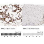 Anti-MKI67 Antibody