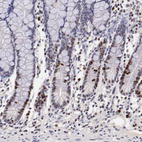 Immunohistochemical staining of human small intestine shows moderate to strong nuclear positivity in glandular cells.