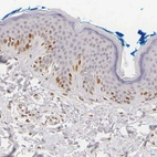 Immunohistochemical staining of human skin shows moderate to strong nuclear positivity in a subset of keratinocytes.