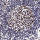 Anti-MKI67 Antibody