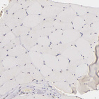 Immunohistochemical staining of human skeletal muscle shows no positivity in myocytes as expected.
