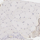 Anti-MKI67 Antibody