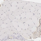 Immunohistochemical staining of human skeletal muscle shows no positivity in myocytes as expected.