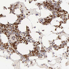 Anti-MKI67 Antibody