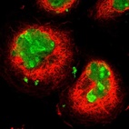 Immunofluorescent staining of human cell line A-431 shows localization to nucleus & nucleoli.