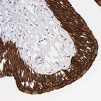 Immunohistochemical staining of human urinary bladder shows strong cytoplasmic positivity in urothelial cells.