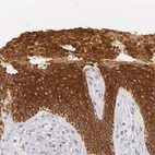 Immunohistochemical staining of human skin shows strong cytoplasmic positivity in squamous epithelial cells.