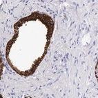 Immunohistochemical staining of human prostate shows strong membranous and cytoplasmic positivity in glandular cells.