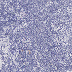 Anti-KRT17 Antibody