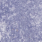 Immunohistochemical staining of human lymph node shows no positivity in non-germinal center cells as expected.