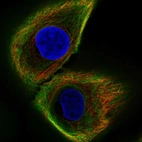 Immunofluorescent staining of human cell line hTCEpi shows localization to intermediate filaments.
