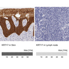 Anti-KRT17 Antibody