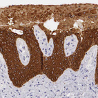 Immunohistochemical staining of human skin shows strong cytoplasmic positivity in squamous epithelial cells.