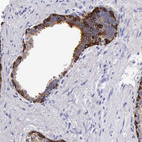 Immunohistochemical staining of human prostate shows strong membranous positivity in glandular cells.